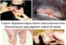 ҚОРАМОЛЛАРДА ОҚСИЛ КАСАЛЛИГИ